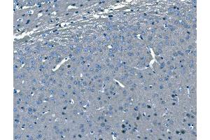 IHC analysis of B Raf/BRAF using anti-B Raf/BRAF antibody (ABIN3043761). (BRAF 抗体  (AA 38-230))