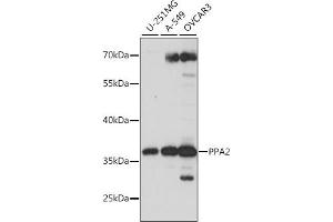 Western blot analysis of extracts of various cell lines, using PP antibody (ABIN7269763) at 1:1000 dilution. (PPA2 抗体  (AA 33-100))