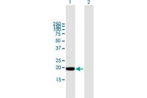 Western Blot analysis of MRPL49 expression in transfected 293T cell line by MRPL49 MaxPab polyclonal antibody. (MRPL49 抗体  (AA 1-166))