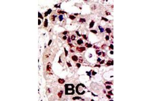 Immunohistochemistry (IHC) image for anti-Protein Inhibitor of Activated STAT, 3 (PIAS3) antibody (ABIN2996753) (PIAS3 抗体)