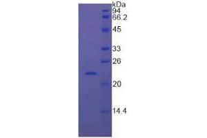 SDS-PAGE analysis of Cow RBP4 Protein. (RBP4 蛋白)