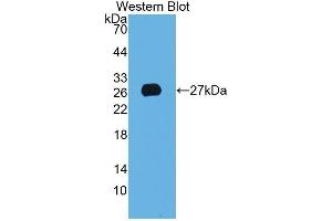 Western Blotting (WB) image for anti-Anterior Gradient Homolog 2 (Xenopus Laevis) (AGR2) (AA 21-175) antibody (ABIN1077802) (AGR2 抗体  (AA 21-175))