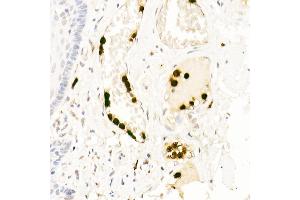 Immunohistochemistry of paraffin-embedded human esophagus using Neutrophil Elastase (ELANE) Rabbit pAb (ABIN6131604, ABIN6140110, ABIN6140111 and ABIN6216843) at dilution of 1:25 (40x lens). (ELANE 抗体  (AA 30-267))