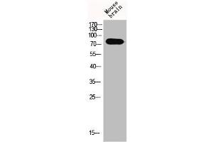 Western Blot analysis of MOuse-brain cells using Epsin 1 Polyclonal Antibody (Epsin 1 抗体  (Internal Region))