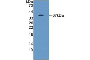 Detection of Recombinant KEAP1, Human using Polyclonal Antibody to Kelch Like ECH Associated Protein 1 (KEAP1) (KEAP1 抗体  (AA 327-624))