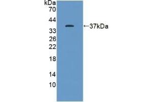 Detection of Recombinant KEAP1, Human using Polyclonal Antibody to Kelch Like ECH Associated Protein 1 (KEAP1)