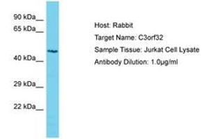 Image no. 1 for anti-Ssu-2 Homolog (C. Elegans) (SSUH2) (AA 184-233) antibody (ABIN6750606) (SSUH2 抗体  (AA 184-233))
