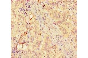 Immunohistochemistry of paraffin-embedded human adrenal gland tissue using ABIN7158878 at dilution of 1:100 (MMP12 抗体  (AA 109-470))