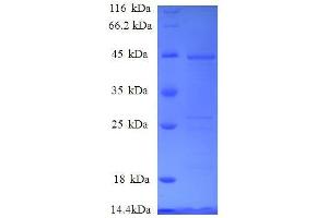 SDS-PAGE (SDS) image for Vesicular, Overexpressed in Cancer, Prosurvival Protein 1 (VOPP1) (AA 23-172), (full length) protein (GST tag) (ABIN1608085)