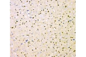 IHC analysis of SHP2/PTPN11 using anti SHP2/PTPN11 antibody (ABIN6719583).