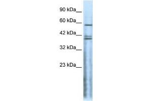 Western Blot showing CHRND antibody used at a concentration of 1-2 ug/ml to detect its target protein. (CHRND 抗体  (N-Term))