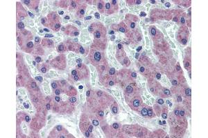 Immunohistochemistry (IHC) image for anti-Solute Carrier Family 27 (Fatty Acid Transporter), Member 2 (SLC27A2) (N-Term) antibody (ABIN2781594)