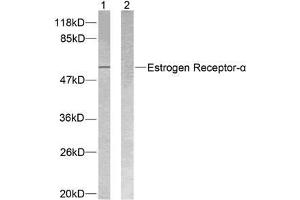 Western blot analysis of extracts from MCF7 cells using Estrogen Receptor-α (Ab-118) antibody (E021067). (Estrogen Receptor alpha 抗体)
