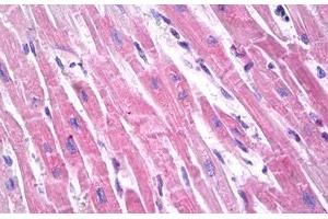 Anti-Brain Natriuretic Peptide 32 antibody IHC staining of human heart. (BNP32 抗体)