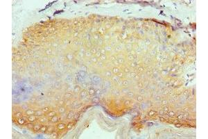 Immunohistochemistry of paraffin-embedded human skin tissue using ABIN7158251 at dilution of 1:100 (SERPINB1 抗体  (AA 100-379))