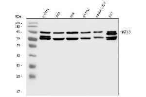 Western blot analysis of BBS9 using anti-BBS9 antibody (ABIN7601518). (BBS9 抗体  (AA 37-793))