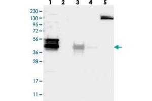 Western blot analysis of Lane 1: RT-4, Lane 2: U-251 MG, Lane 3: Human Plasma, Lane 4: Liver, Lane 5: Tonsil with WDR31 polyclonal antibody  at 1:250-1:500 dilution. (WDR31 抗体)