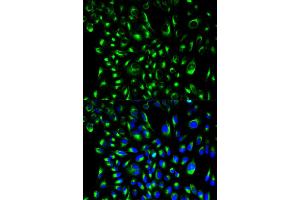 Immunofluorescence analysis of HeLa cells using LCP2 antibody (ABIN6292589). (LCP2 抗体)