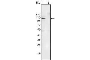 Western Blot showing EphB4 antibody used against Jurkat (1) and HEK293 (2) cell lysate. (EPH Receptor B4 抗体  (AA 562-612))