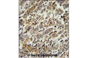 Immunohistochemistry (Paraffin-embedded Sections) (IHC (p)) image for anti-Ankyrin Repeat and SOCS Box Containing 17 (ASB17) (AA 181-209), (C-Term) antibody (ABIN654779)