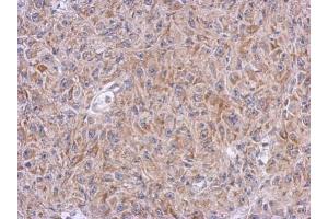 Immunohistochemistry (IHC) image for anti-Aldehyde Dehydrogenase 7 Family, Member A1 (ALDH7A1) antibody (ABIN2855662)