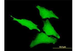 Immunofluorescence of purified MaxPab antibody to CLIC1 on HeLa cell. (CLIC1 抗体  (AA 1-241))