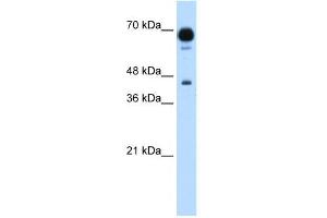 PUS7 antibody used at 1. (PUS7 抗体)