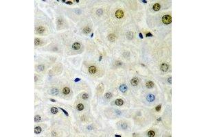 Immunohistochemical analysis of Dysbindin 1 staining in rat liver  formalin fixed paraffin embedded tissue section. (DTNBP1 抗体)