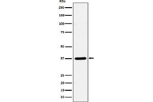Western blot analysis of Syntaxin 16 expression in HeLa cell lysate. (Recombinant Syntaxin 16 抗体)