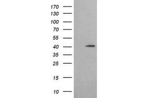 Western Blotting (WB) image for anti-Acetyl-CoA Acyltransferase 2 (ACAA2) antibody (ABIN1495727) (ACAA2 抗体)