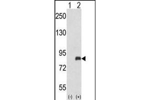Western blot analysis of ADRBK2 (arrow) using rabbit polyclonal ADRBK2 Antibody (N-term) (ABIN653036 and ABIN2842650). (ADRBK2 抗体  (N-Term))