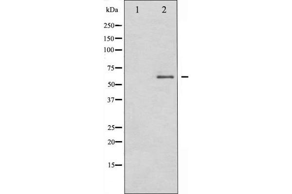 DPYSL2 抗体  (C-Term)