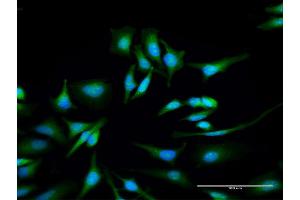 Immunofluorescence of purified MaxPab antibody to ULK4 on HeLa cell. (ULK4 抗体  (AA 1-580))
