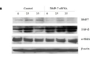 Western Blotting (WB) image for anti-Actin, alpha 2, Smooth Muscle, Aorta (ACTA2) (N-Term) antibody (ABIN2857027)