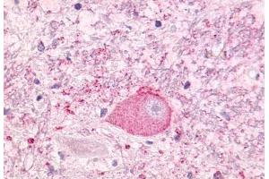 Anti-NTSR1 antibody  ABIN1049155 IHC staining of human brain, neurons and glia. (NTSR1 抗体  (Cytoplasmic Domain))