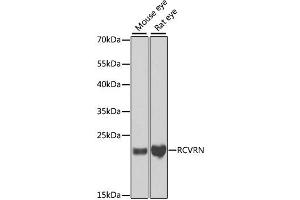 Western blot analysis of extracts of various cell lines, using RCVRN antibody. (Recoverin 抗体)