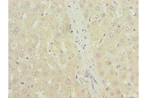 Immunohistochemistry of paraffin-embedded human liver tissue using ABIN7172018 at dilution of 1:100 (TXNRD1 抗体  (AA 1-497))