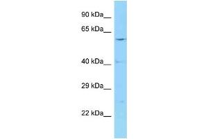 WB Suggested Anti-CCT2 Antibody Titration: 1. (CCT2 抗体  (Middle Region))