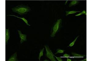 Immunofluorescence (IF) image for anti-Proliferating Cell Nuclear Antigen (PCNA) (AA 78-177) antibody (ABIN518692)
