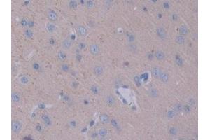 Detection of STAM1 in Rat Cerebrum Tissue using Polyclonal Antibody to Signal Transducing Adaptor Molecule 1 (STAM1) (STAM 抗体  (AA 199-466))