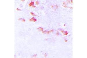 Immunohistochemical analysis of Synapsin 1 (pS9) staining in human brain formalin fixed paraffin embedded tissue section. (SYN1 抗体  (N-Term, pSer9))