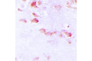 Immunohistochemical analysis of Synapsin 1 (pS9) staining in human brain formalin fixed paraffin embedded tissue section.