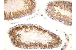 FGF8 Polyclonal Antibody (FGF8 抗体  (C-Term))