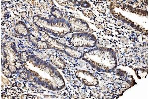 IHC analysis of Caspase-7/CASP7 using anti-Caspase-7/CASP7 antibody (ABIN7600823).