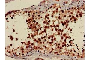 Immunohistochemistry (IHC) image for anti-Protein Kinase, AMP-Activated, gamma 1 Non-Catalytic Subunit (PRKAG1) (AA 1-331) antibody (ABIN7142682)