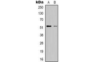 Western blot analysis of RSAD1 expression in HepG2 (A), Hela (B) whole cell lysates. (RSAD1 抗体)