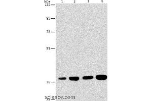 Western blot analysis of 293T and 231 cell, U937 and Raji cell, using SERPINA9 Polyclonal Antibody at dilution of 1:337. (SERPINA9 抗体)