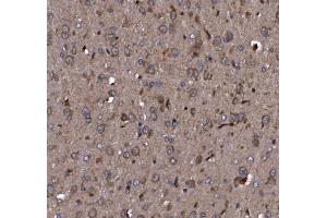 IHC analysis of KLHL12 using anti-KLHL12 antibody (ABIN7601009).