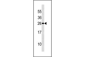 DENR Antibody (Center) (ABIN1881257 and ABIN2843223) western blot analysis in 293 cell line lysates (35 μg/lane). (Density Regulated Protein 抗体  (AA 47-76))