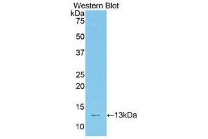 Western Blotting (WB) image for anti-Transcription Factor 20 (TCF20) (AA 1871-1965) antibody (ABIN1860689)